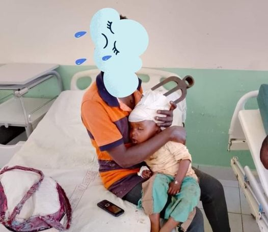 How Boy aged 2 died with fork jembe lodged in skull at KNH