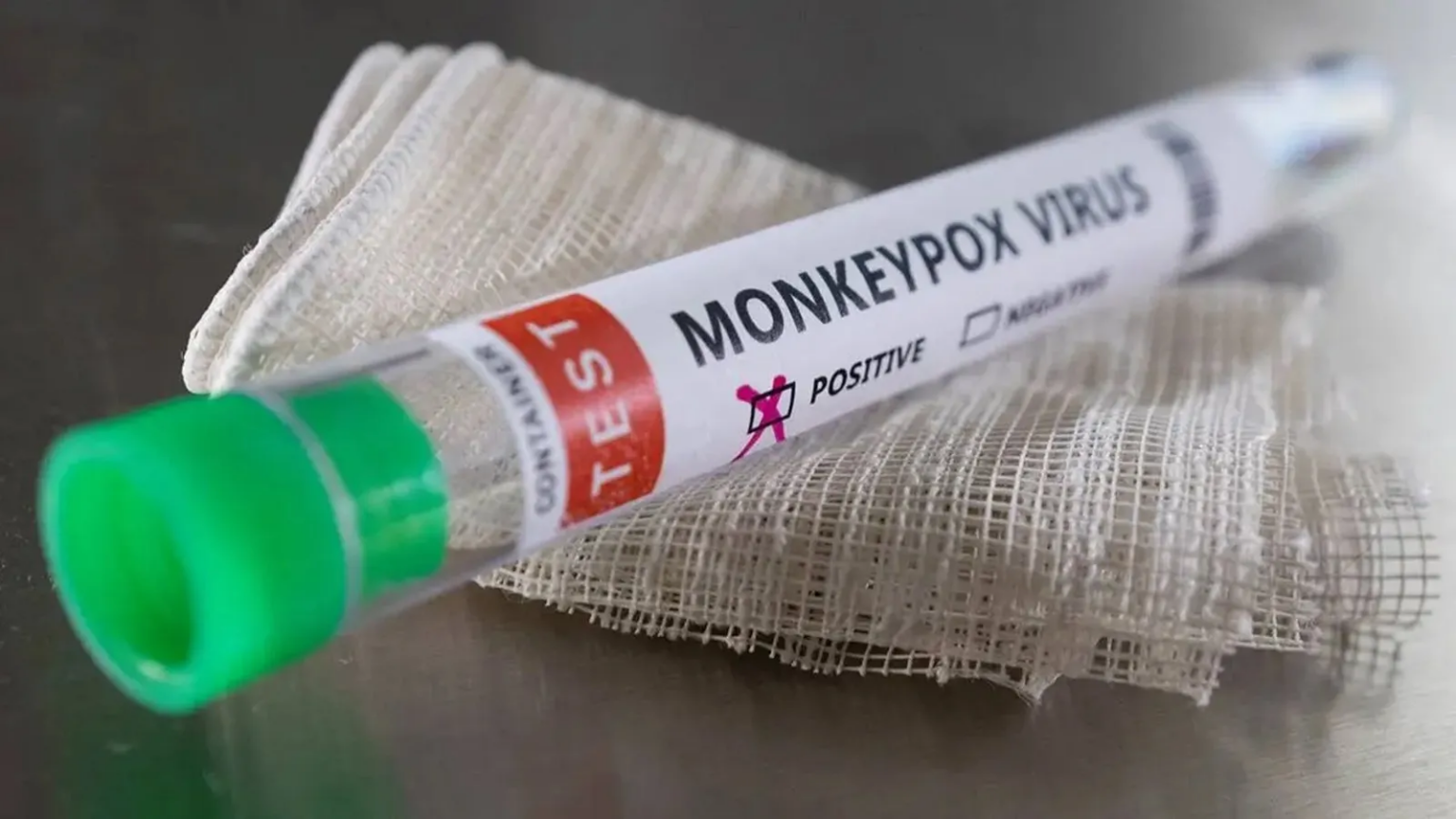 Monkeypox What is it? Transmission, Symptoms, Prevention, Treatment