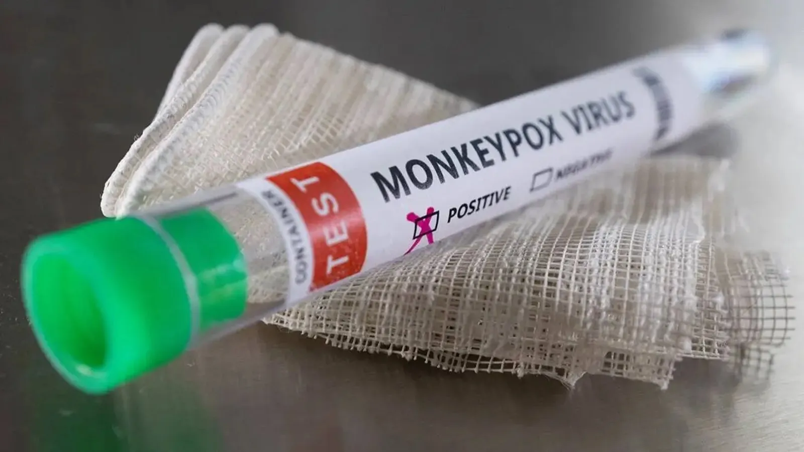 Monkeypox: What is it? Transmission, Symptoms, Prevention, Treatment